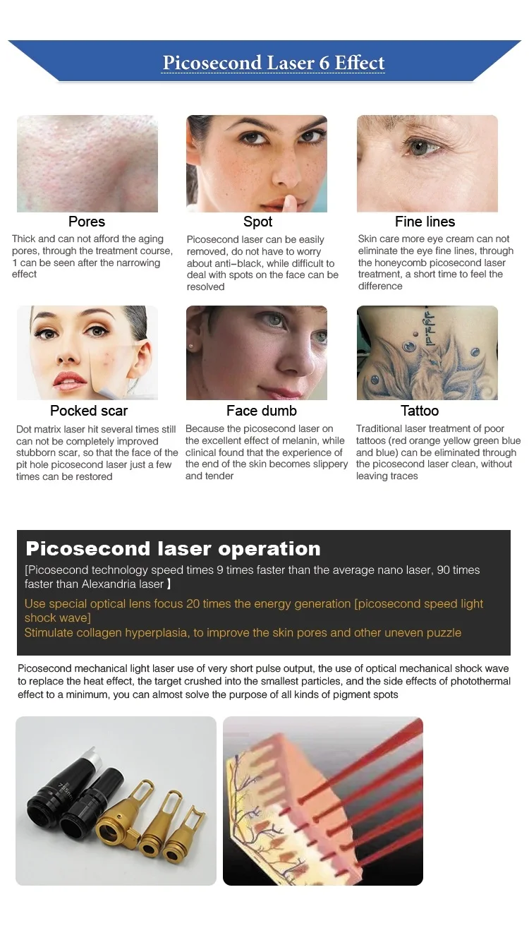 High power portable picosecond laser tattoo removal machine for salon use