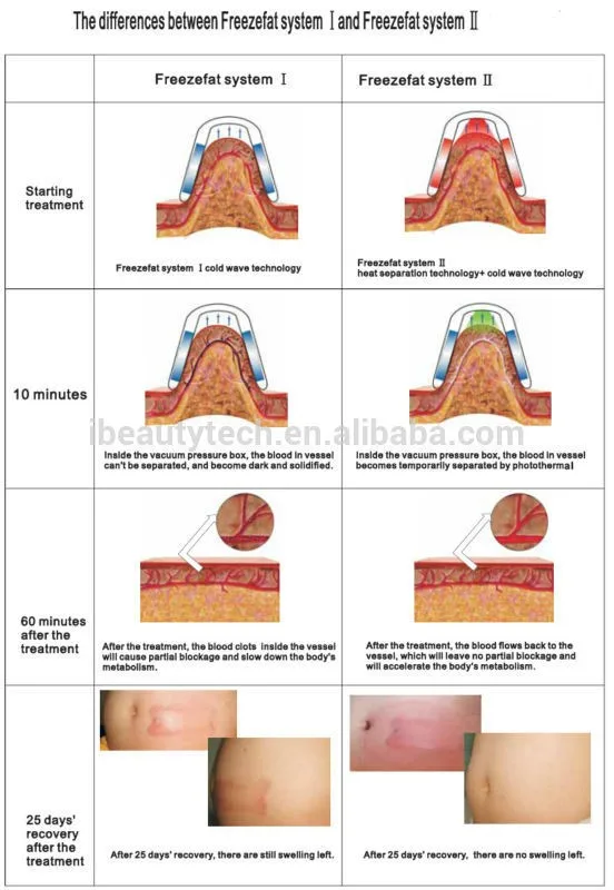 Weight loss stomach area image 3