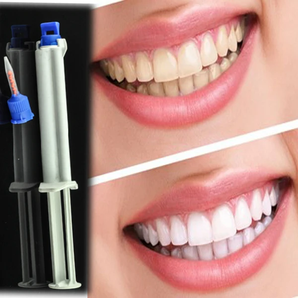 blanchiment des dents avec peroxyde blanchiment des dents avec peroxyde