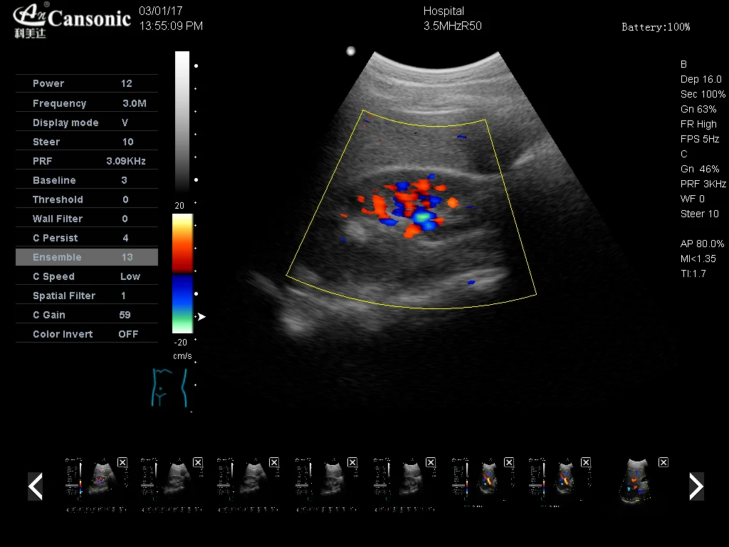 K2 Kidney Color .jpg