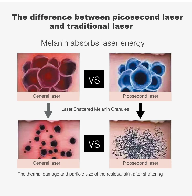 Picosecond Laser Beauty Instrument Nd Yag Laser Tattoo Removal 1064 / 532 / 755 nm Laser Machine