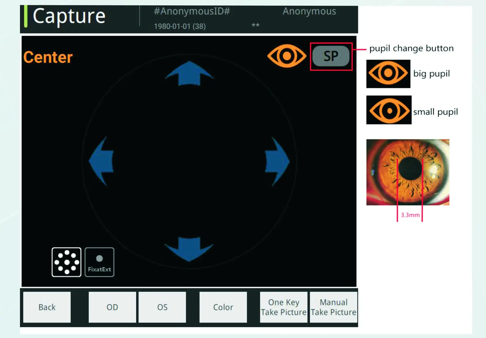 retinal camera