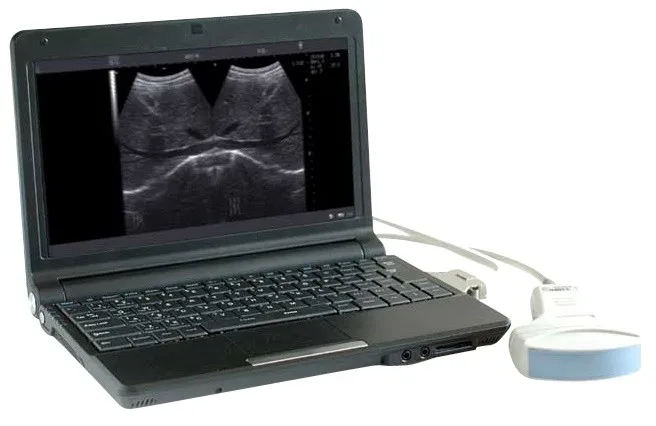 portable PC Notebook digital diagnostic ultrasound scanner WT-6000B