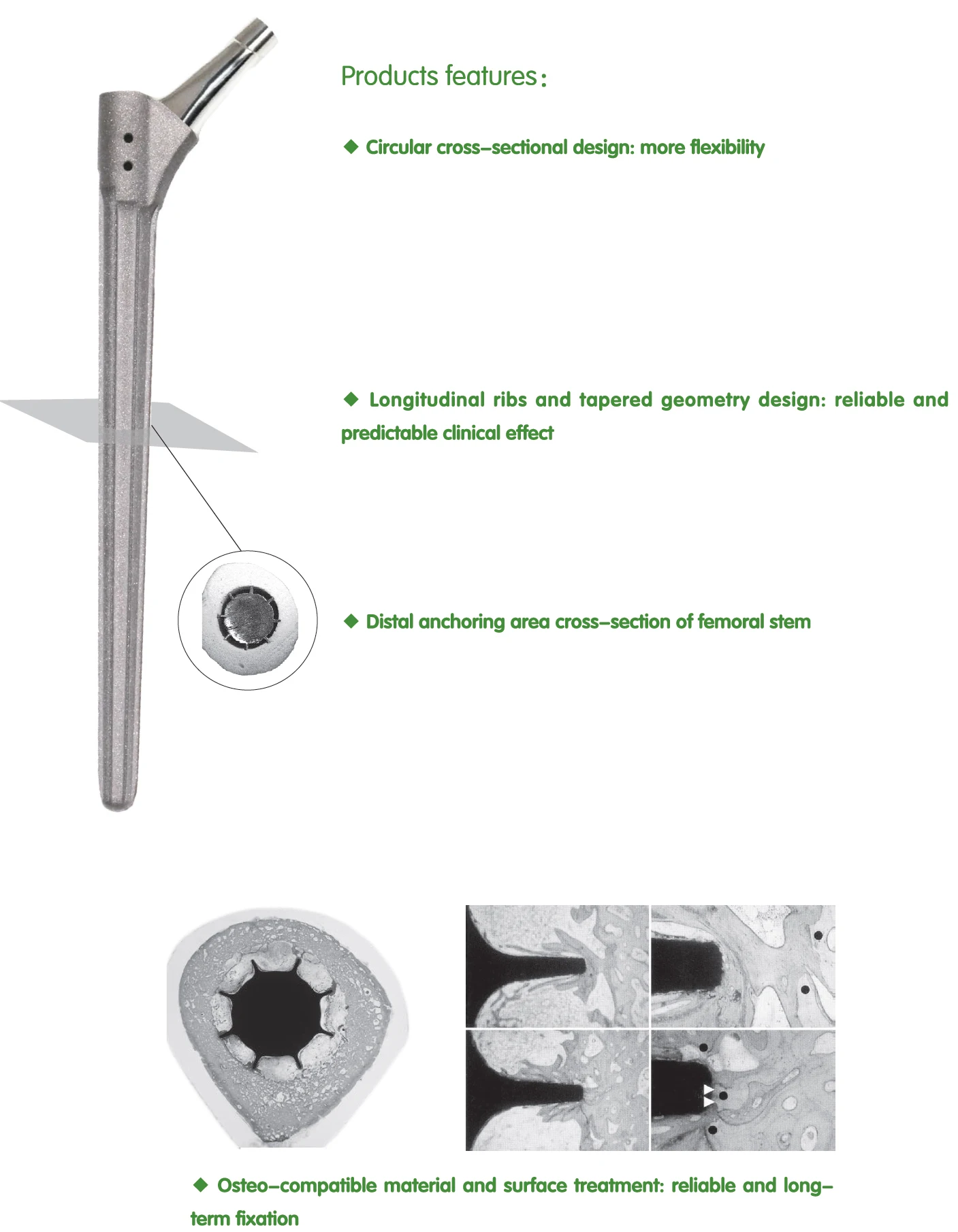 GMP Certified hip prosthesis Revision Stem Orthopedic Implant For total replacement Hip Joint
