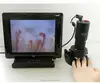 DMX980 Microscope microcirculation Microvascular capillary microscope