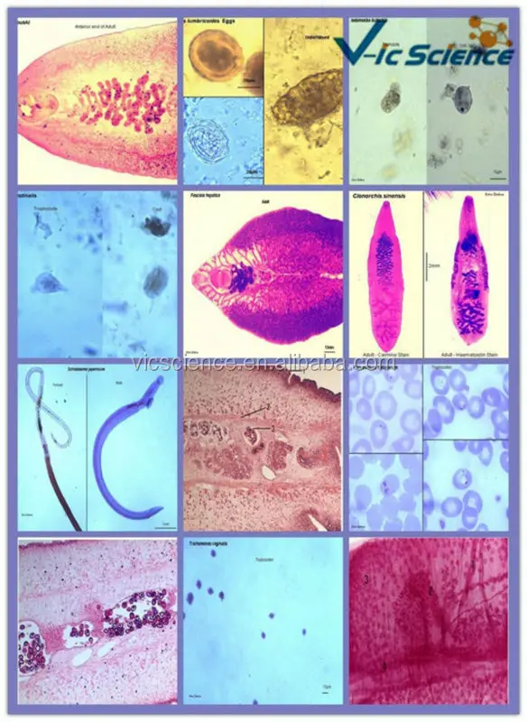 School teaching medical parasitology prepared slides set parasitology ...