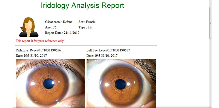 best body scanner machine spanish biometric eye iris iridology iriscope camera/cameras equipment for health digital analysis