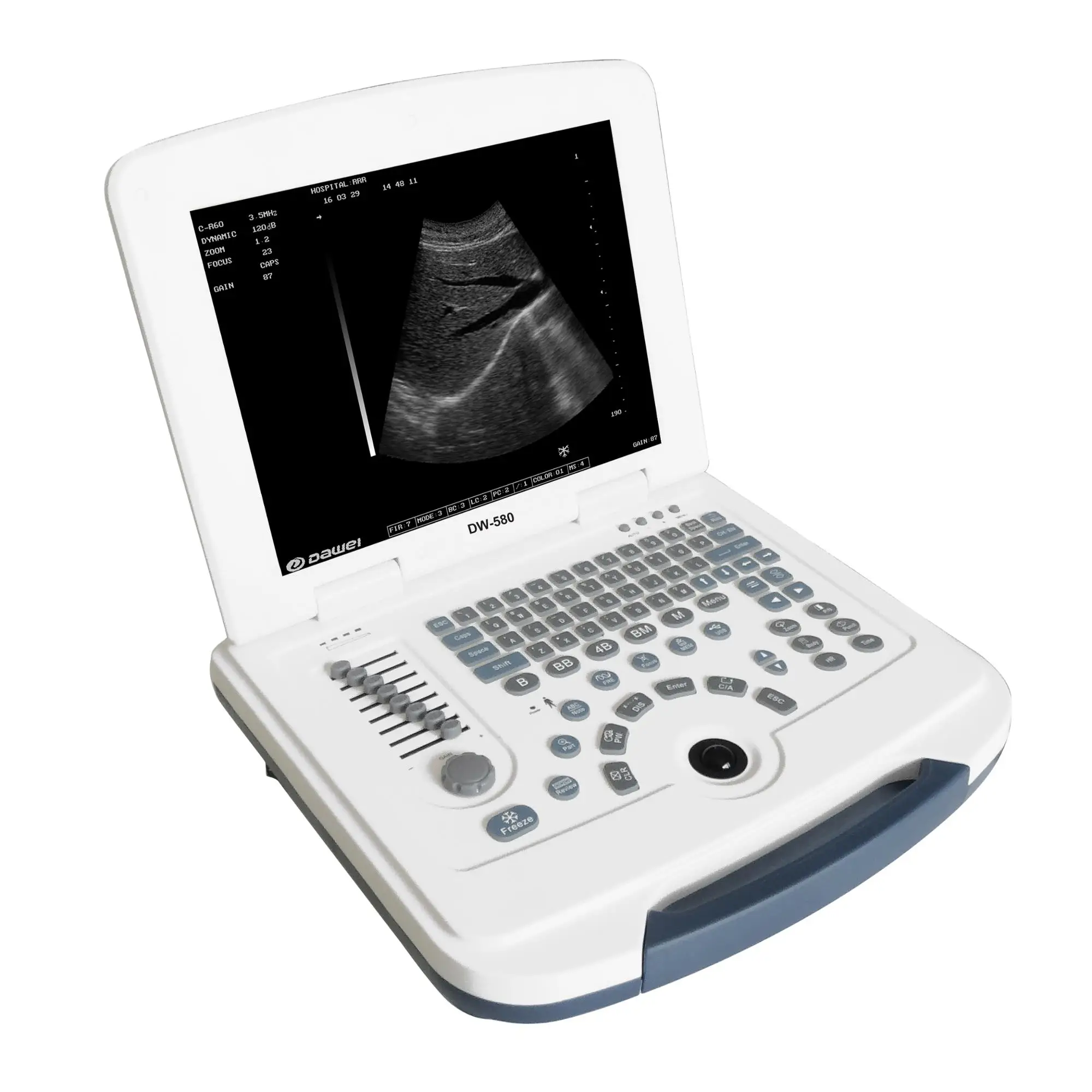 WT-51353ALCD Medical Instrument 12 Inch LCD Digital Laptop Ultrasound Unit