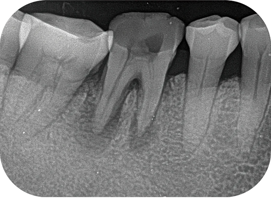 Рентгеновские пластины. Селеновые пластины в рентгенаппарате. Dental Imaging Plate Scanner.