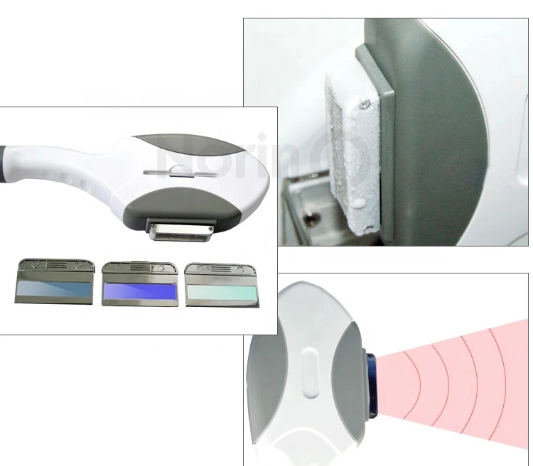 ipl hair removal.jpg