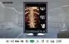 31 (JUSHA-C23C )dental intraoral x-ray scanner,old lcd monitor,lcd light screen