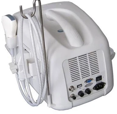 The back of the Portable Ultrasound Scanner.jpg