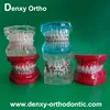 Denxy Ortho Manufacturer ceramic braces models Orthodontic models orthodontic brackets