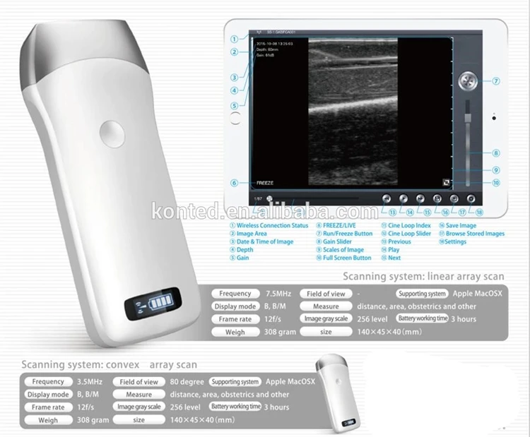 Wifi Wireless Doppler Probe Cheapest Portable Ultrasound Machine Buy