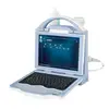 Cheap price MSLBD01 Automatic High Effective Ultrasound Bone Densitometer