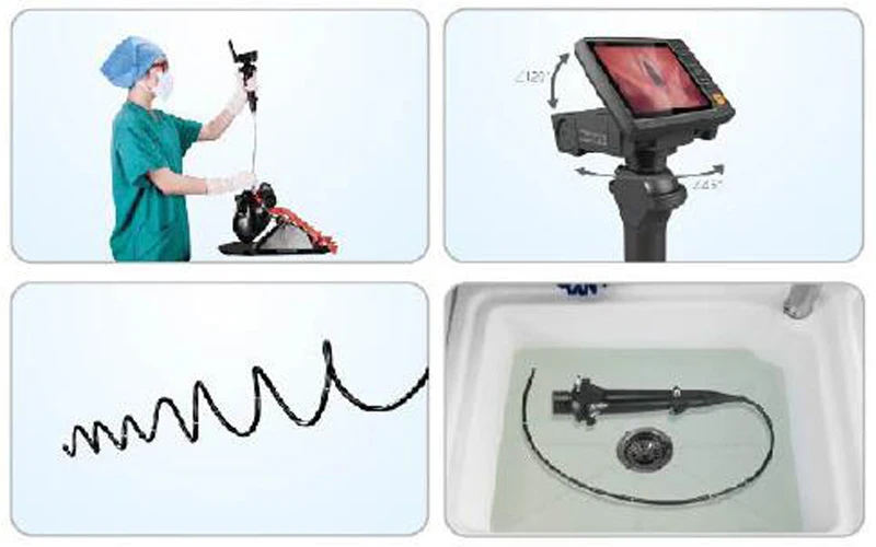 endoscope