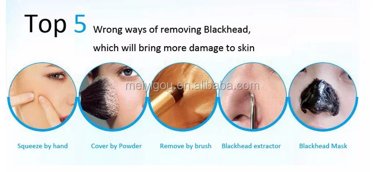 New arrival Cleaner Comedo Blackhead vacuum Remove with vacuum Suction blackhead with replacement 5 heads