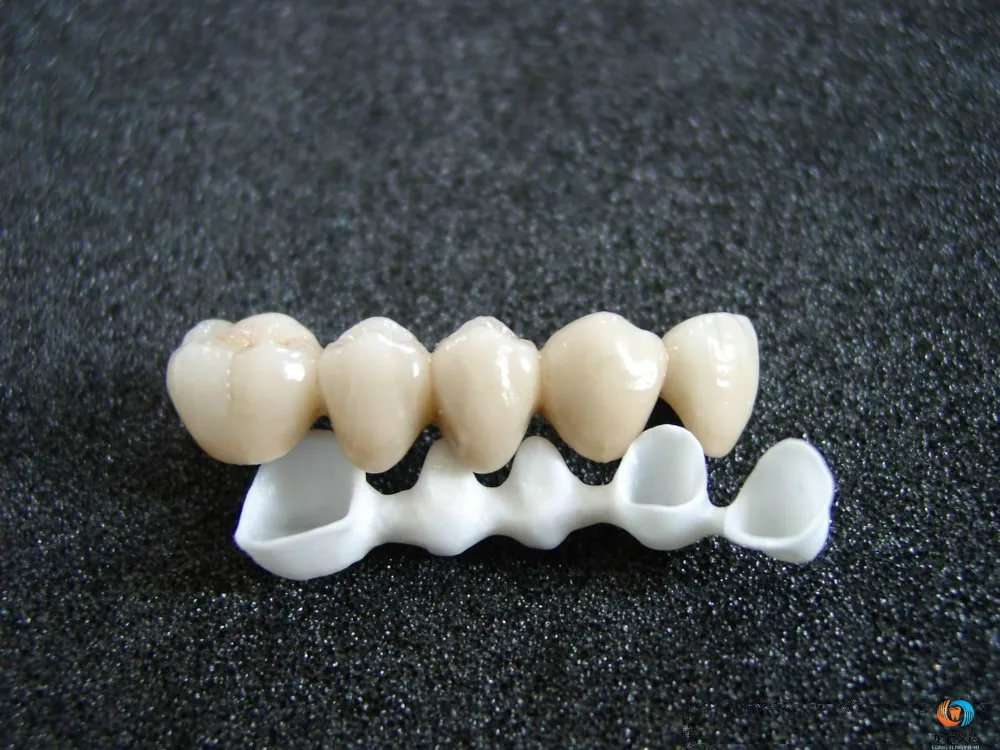 Циркониевые коронки для зубов преимущества и недостатки фото