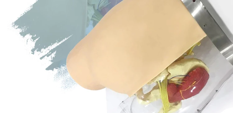 8 Injection model.jpg