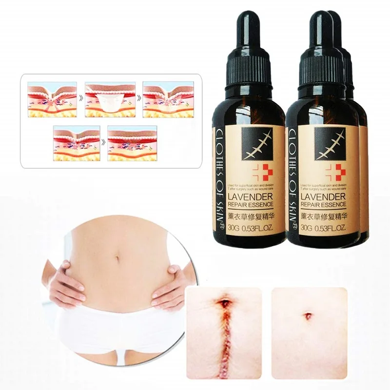 scar repair liquid (6).jpg