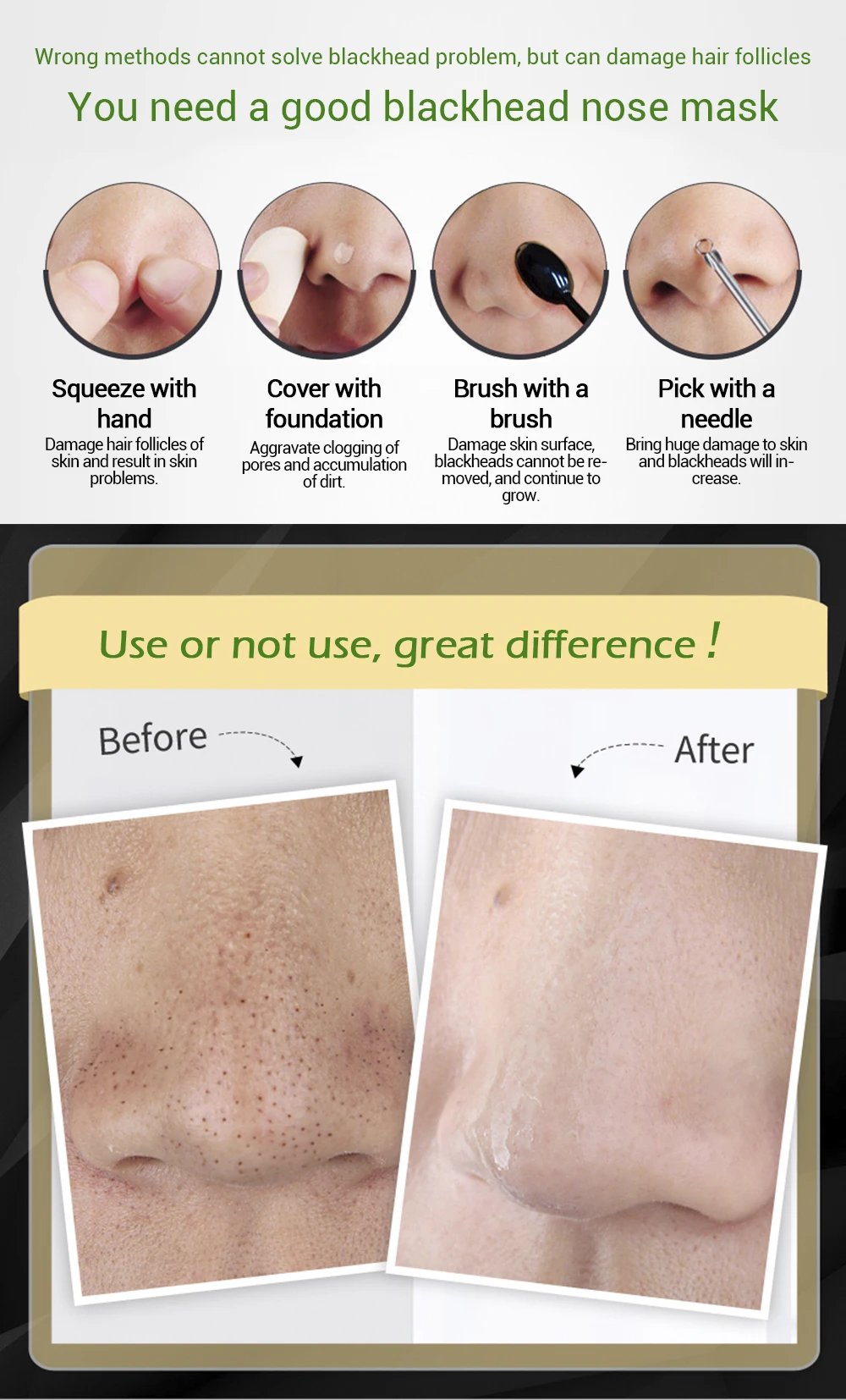 LANBENA Blackhead Remover Nose Masks Acne Treatment Peeling Black Mask Pore Strip Deep Cleaning Peel Mask Skin Care 10PCS