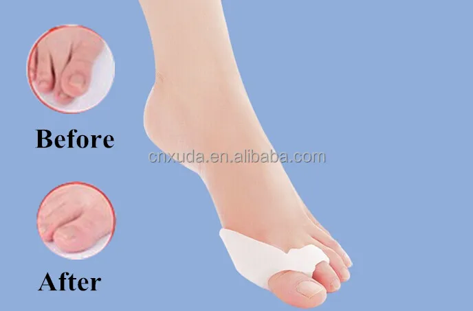 shoe insert for bunion