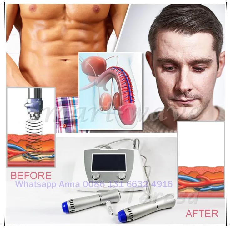 Penis Low Intensity Shock Wave Therapy Machine Erectile Dysfunction Shockwave Therapy Portable 9199