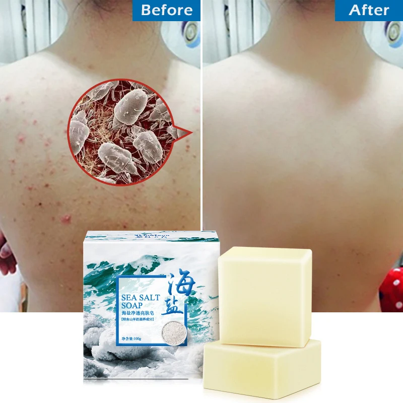 Milk Whitening Herbal Soap Acne Gluta Collagen Face Care Bath Wash Basis Soap Sea Salt Removal Pimple Pores Acne Treatment Goat