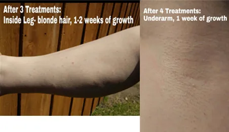 before after 2.jpg