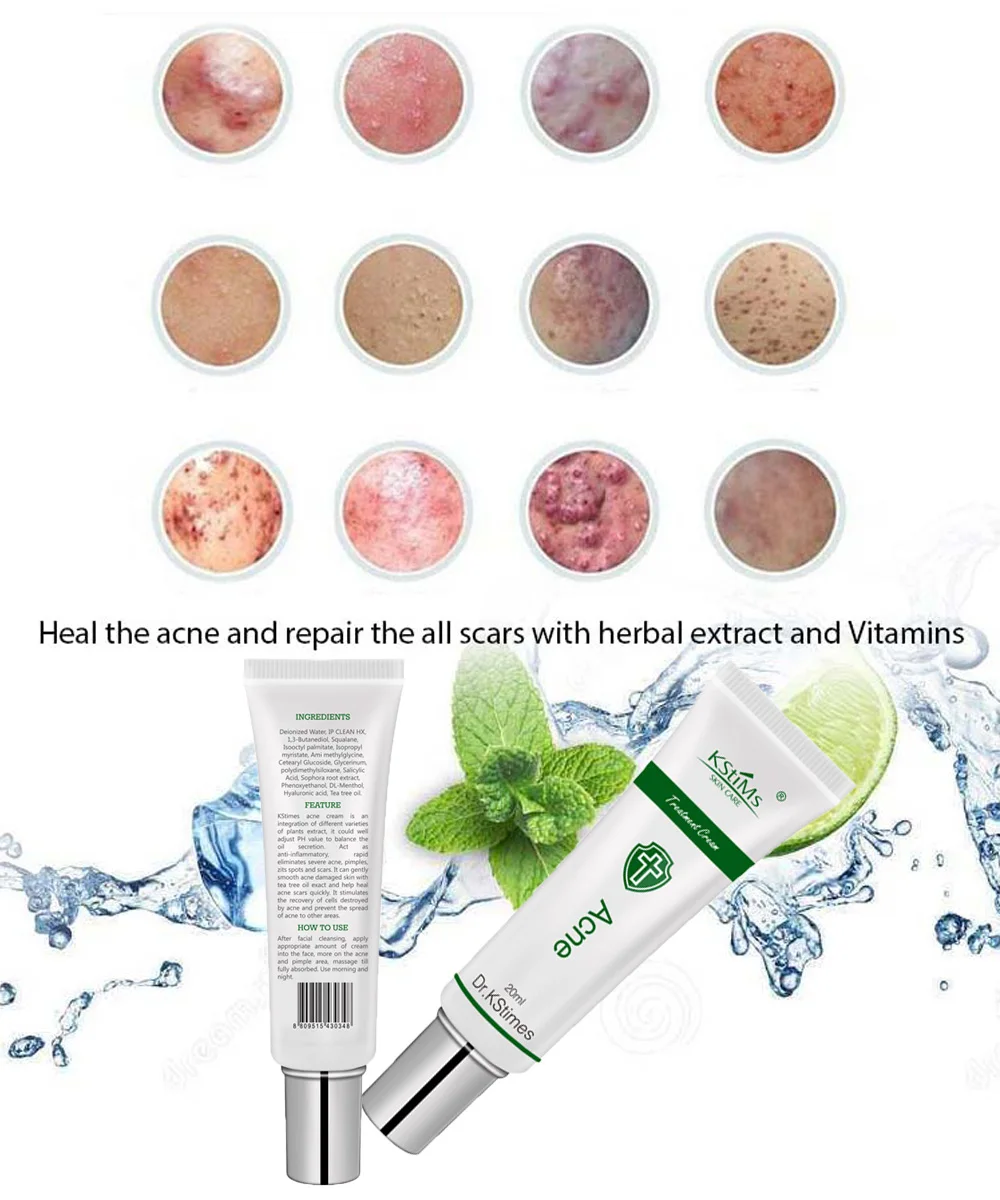 instant acne removal cream