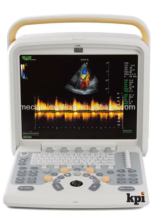 Cardiac Vascular doppler