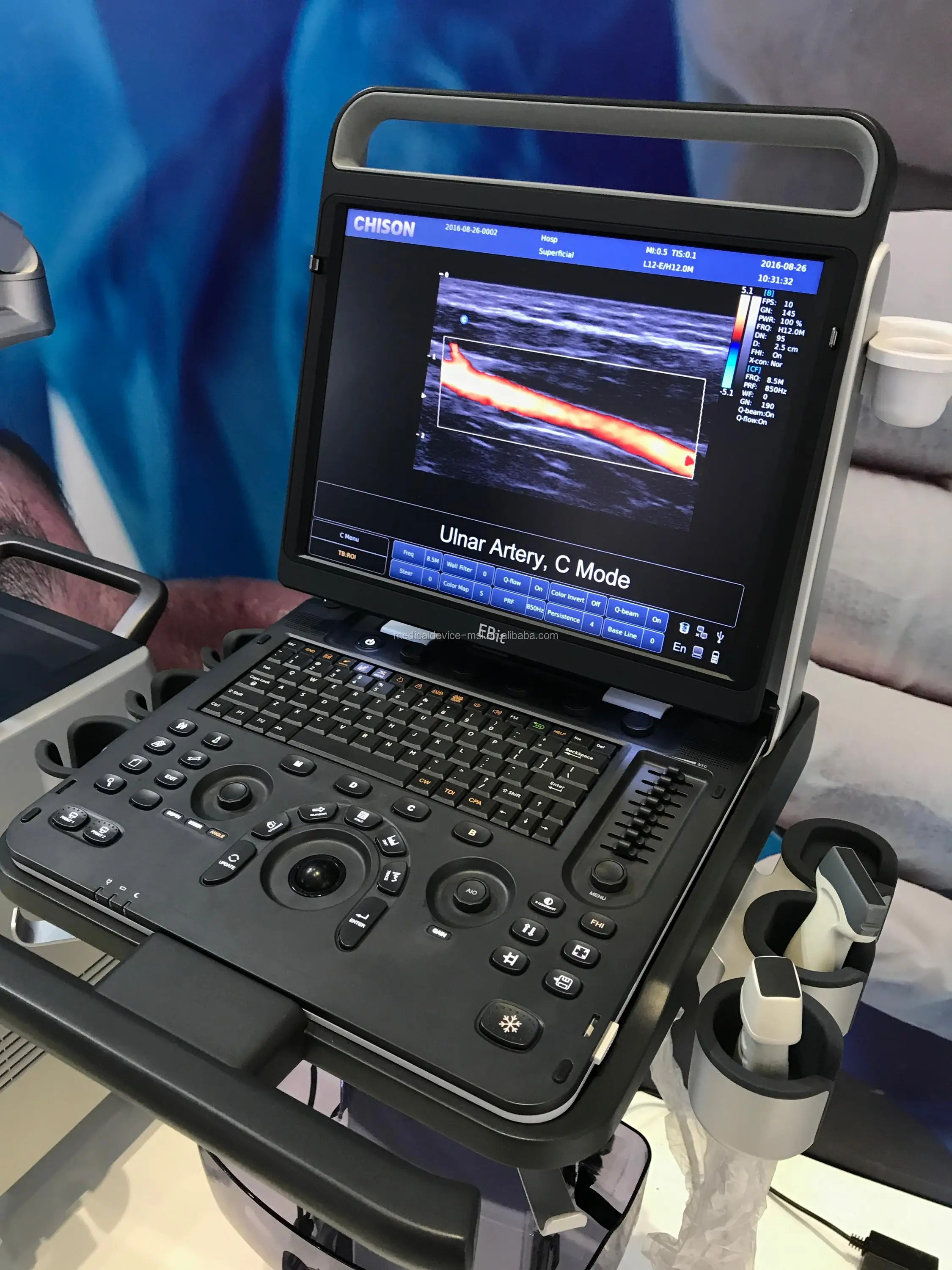 Professional Cardiology/msk Portable Color Doppler Echo Ultrasound