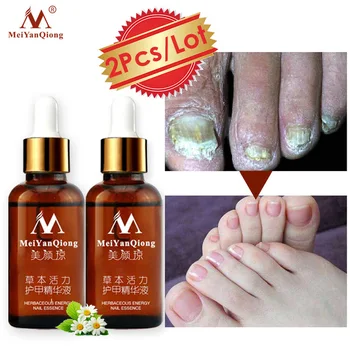 Nail Fungal Infection Treatment At Home 2pcs lot nail fungus treatment onychomycosis paronychia anti fungal nail infection good result chinese herbal