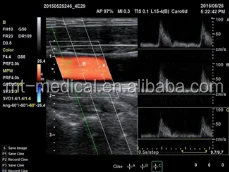 Portable Ultrasonic Diagnostic Devices Type Ultrasound Machine For Pregnancy
