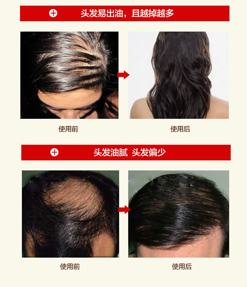 Resistência à Perda de Crescimento do Cabelo Cuidado do Cabelo Preto e Brilhante Shampoo Cabelo Tratamento Profissão Mostrando Suave 7 High Quality Beleza e saúde