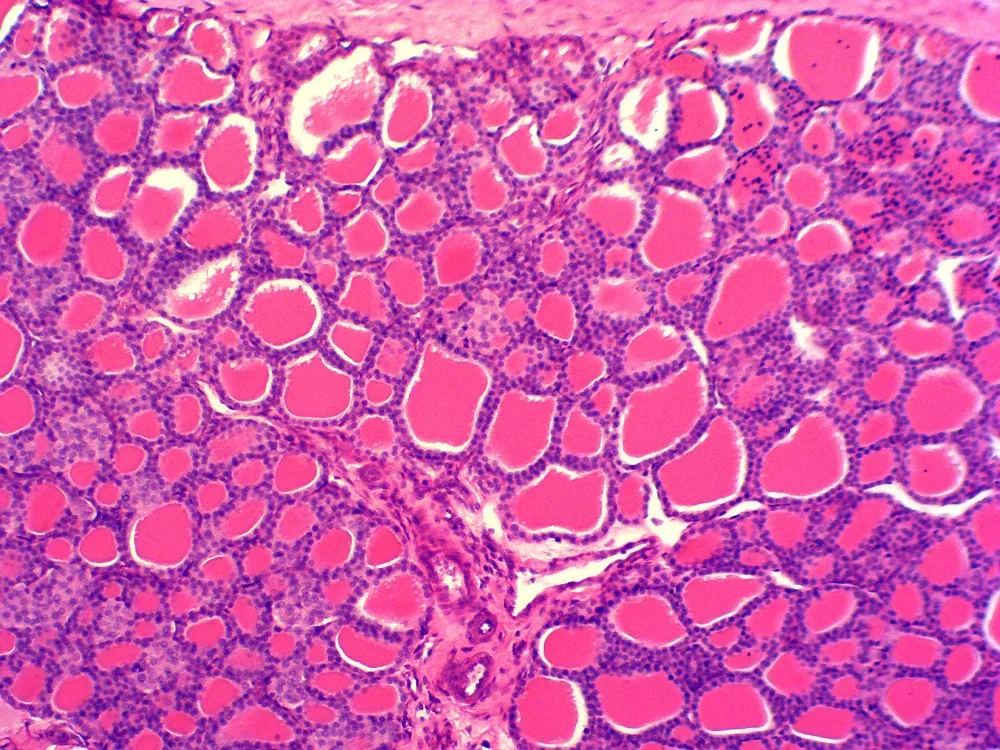 Histologie Gewebe Mikroskop Bereitete Lehr Objekttr Ger Vor Buy   HTB1dGB8OFXXXXccXXXXq6xXFXXXl 