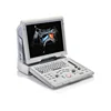 Mindray Z6 cheapest portable ultrasound machine, color doppler ultrasound price