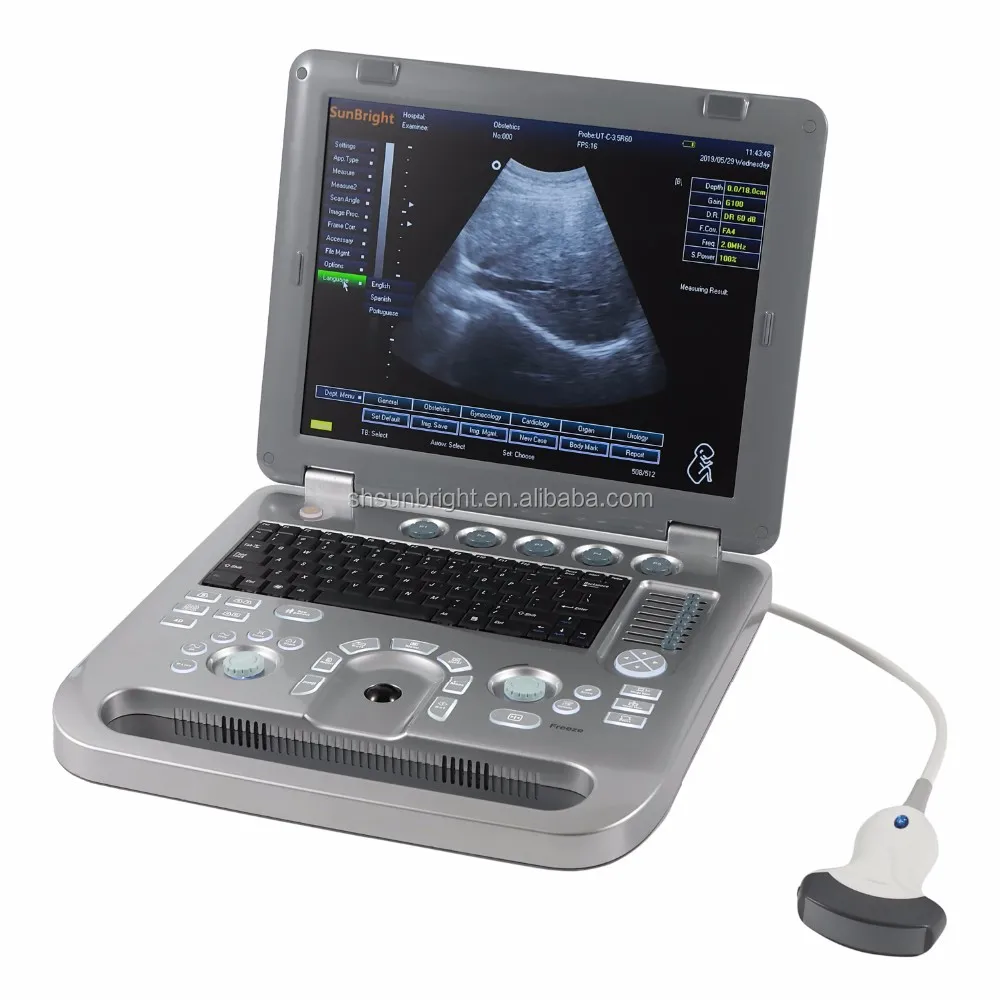 Ce Portable Digital Doppler Ultrasound System Ecografo Similar Mindray