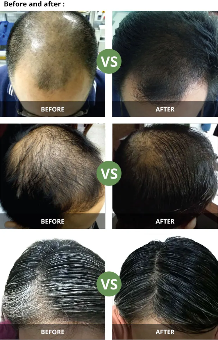 Coconut Oil And Anti Grey Hair Treatment Serum View Hair Serum Joy