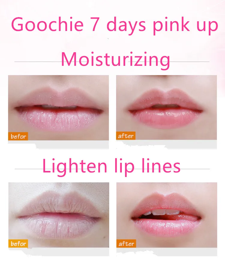 Lip Lightening Cream For Dark Lips - Buy Lip Lightening Cream For Dark ...