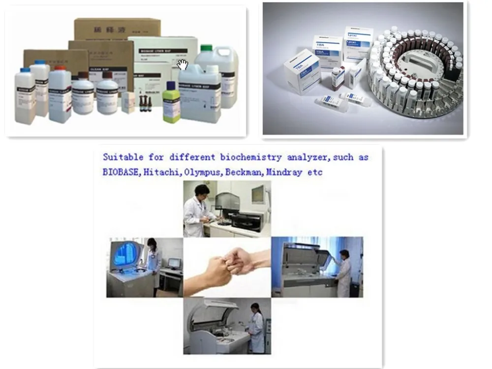 Biochemical analysis. Реагенты для биохимических анализаторов. Roche реагенты. Химические компоненты диагностических наборов.. Анализатор лабораторный анион 4100.