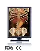(JUSHA-C33C) 3MP Color Medical Display,agfa x-ray film,lcd monitor spare parts,vita cr system