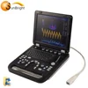Internal medical diagnostic database 4d ecografo color doppler