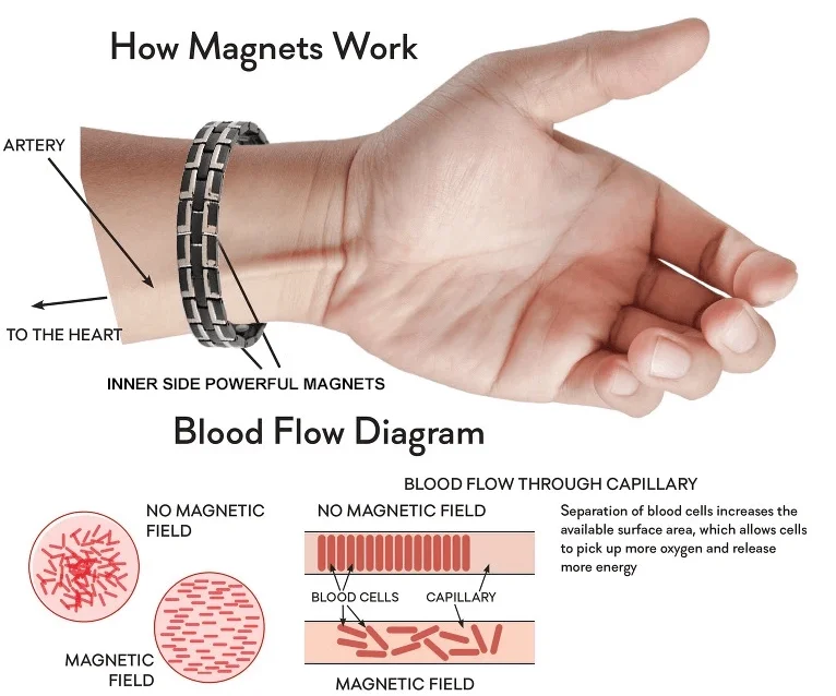 magnetic bracelet