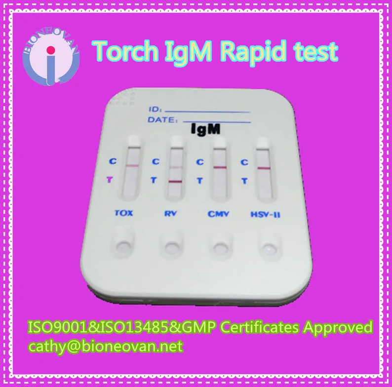 Serology Kits Torch Toxoplasma Rapid Test, View Serology Kits Torch ...