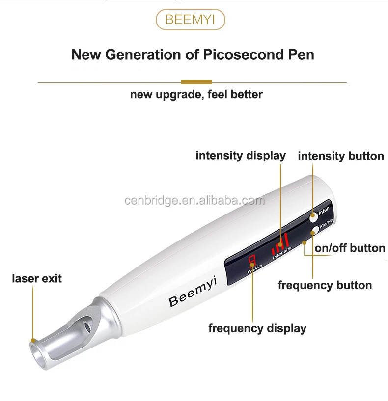 laser removal tattoo