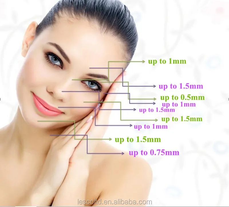 540-derma-roller
