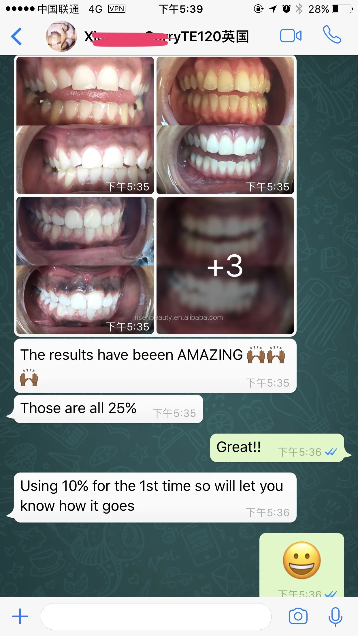 Where to buy elegant smile teeth whitening