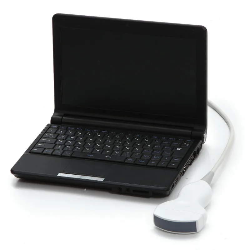 New Digital Portable Laptop Ultrasound Machine Scanner +convex Probe