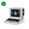 Digital High Resolution Sector Scanning Portable Ultrasound Ophthalmic Equipment A/B Scan